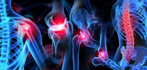 Picture of orthopaedic surgery treatment